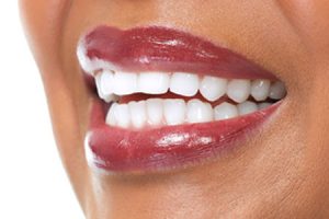 teeth whitening grande prairie