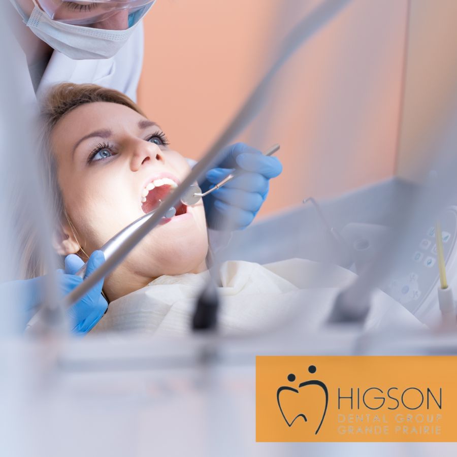 higson dental root canal