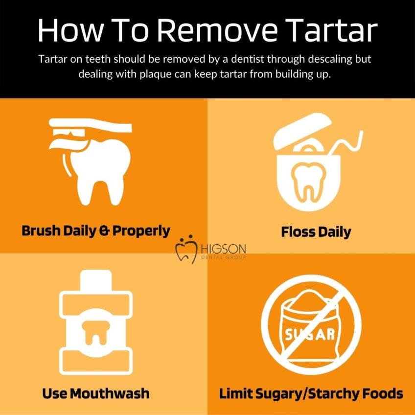 BEST Tartar Removal Near You How Much Does Tartar Removal Cost