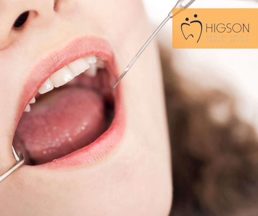 BEST Tartar Removal Near You How Much Does Tartar Removal Cost