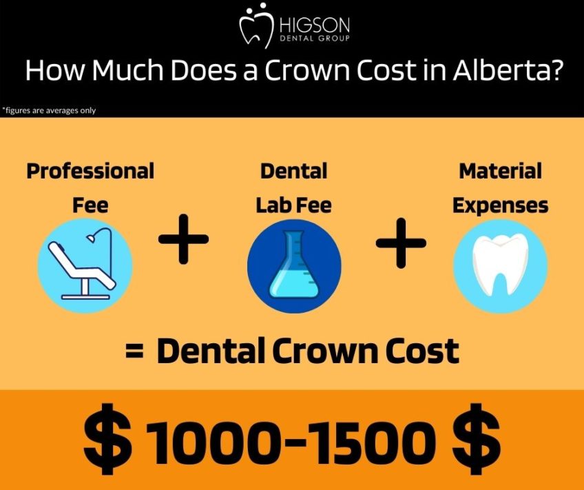 BEST Dental Crowns Grande Prairie AB LongLasting Tooth Restoration