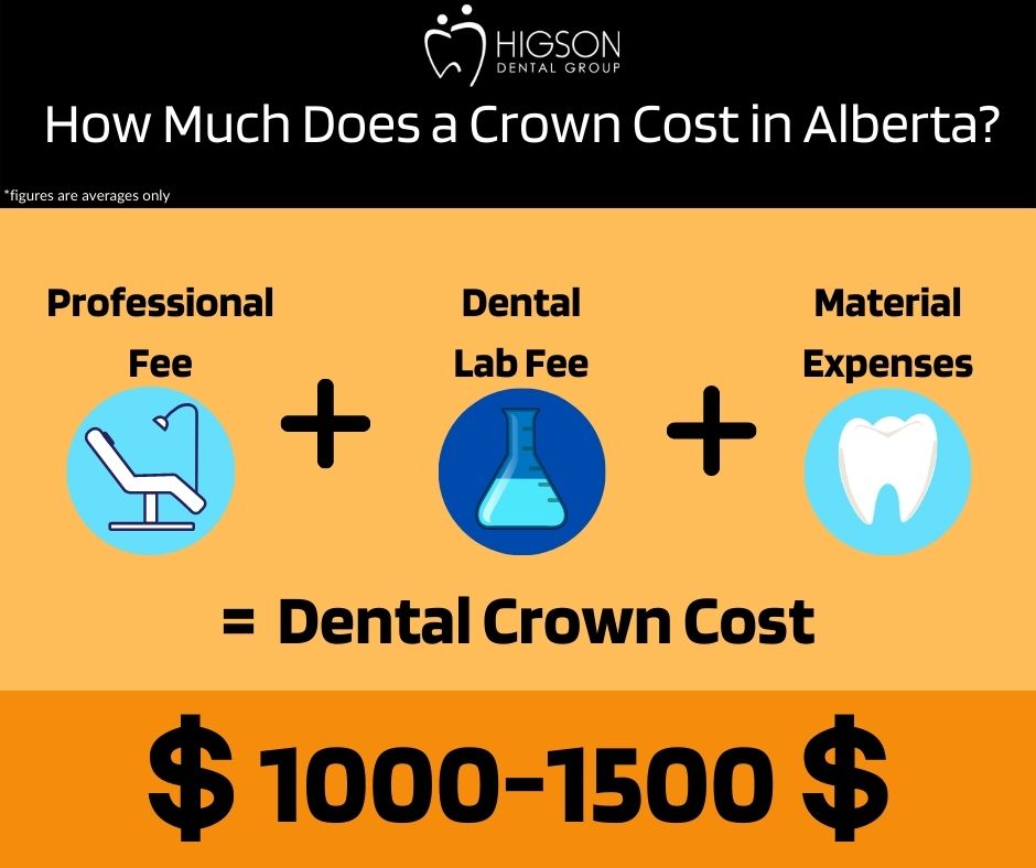 How Much Does a Crown Cost in Alberta higson dental