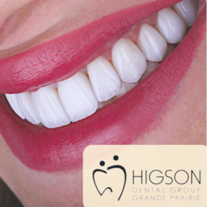 Higson Dental Full Mouth Reconstruction