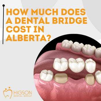 Higson Dental Group Dental Bridge Cost in Alberta